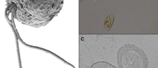 Golden Algae
